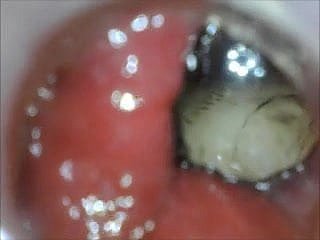 Le cul endoscope anal jouent de l'intérieur